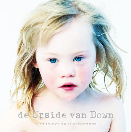 De upside van Down! / een positieve kijk op het downsyndroom